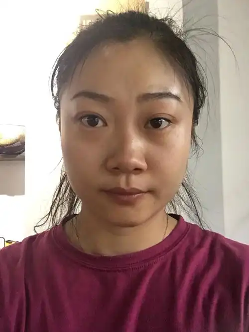 我的大饼脸啊啊啊啊啊,国字脸无可救药,还有面部肌肉_圈子-新氧美容