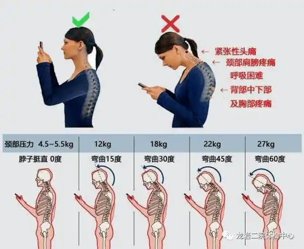 脖子前倾怎么办?_颈椎