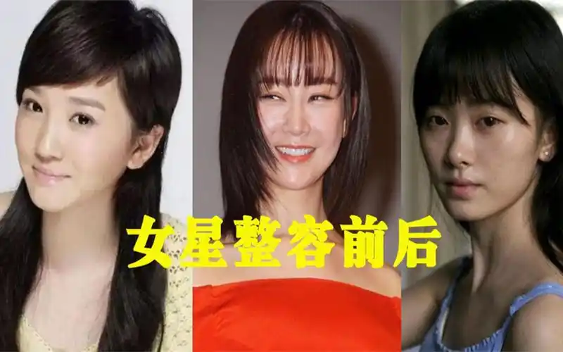 明星整容前后对比,陈小纭改头换面成少女,鞠婧祎脱胎换骨变顶流