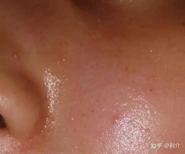 皮肤粗糙毛孔粗大面部出油黑头多怎么办3招轻松解决男士护肤极简教程