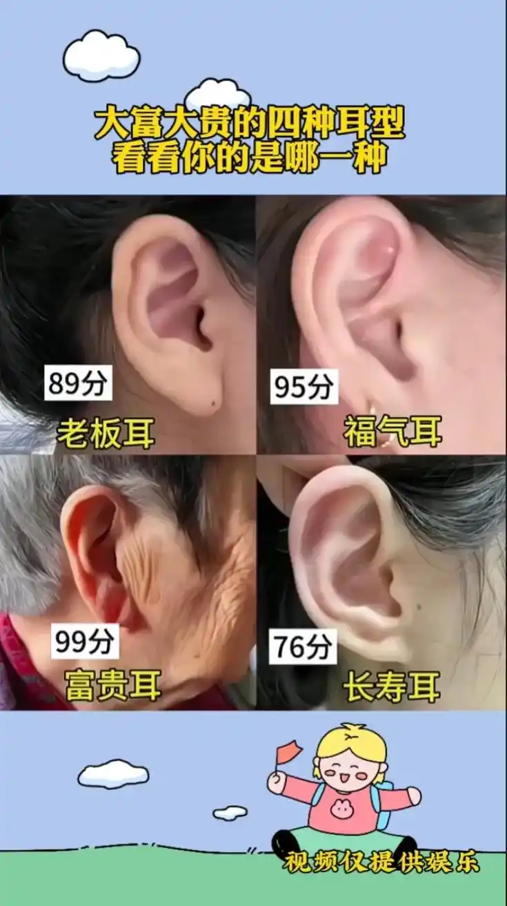 你是哪种耳型 #你是什么耳型 #耳朵大有福 #耳朵 #图文 - 抖音