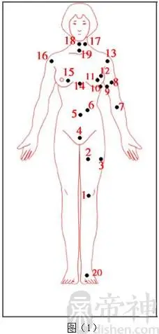 女痣的位置与命运图