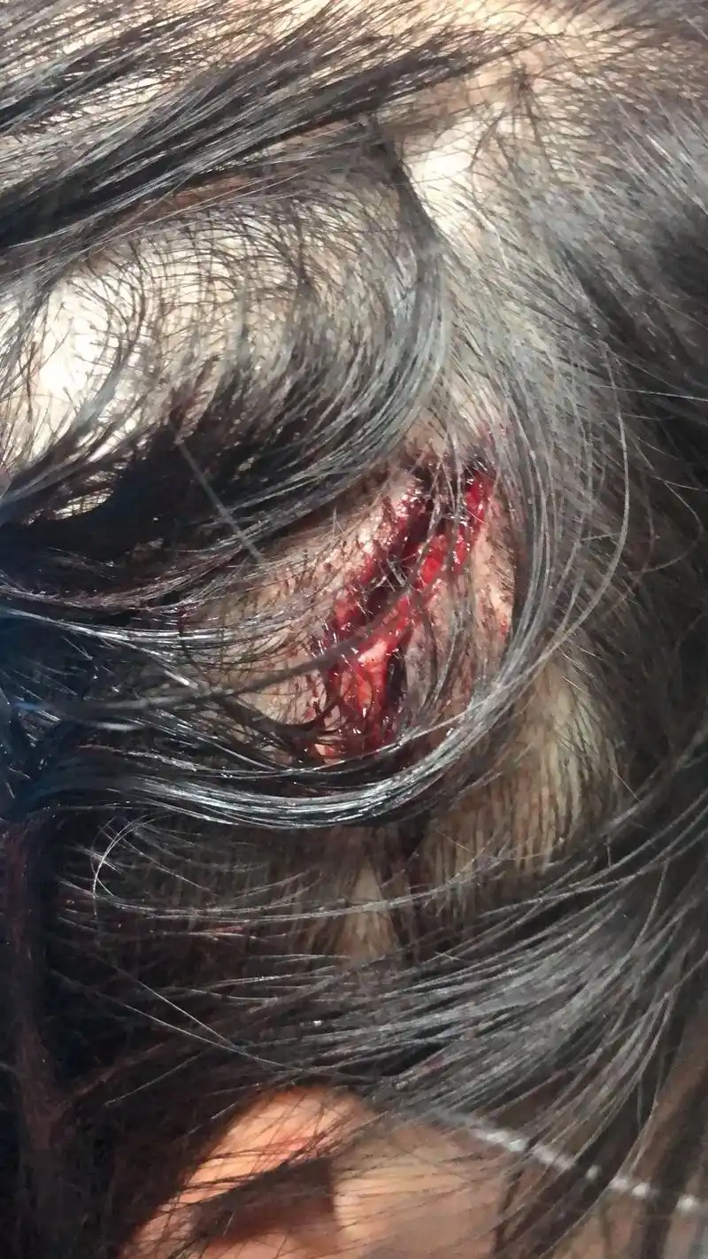 人生第一次被车撞,被撞的那一瞬间脑袋懵掉了,那