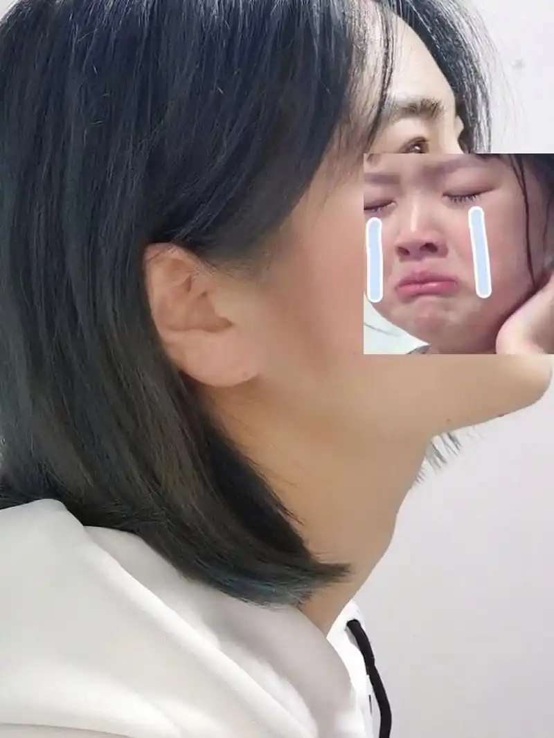 女生长喉结是不是不正常? 各位刘亦菲们!