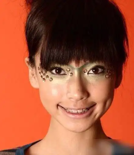 baby自黑晒牙套丑照没有最丑只有更丑