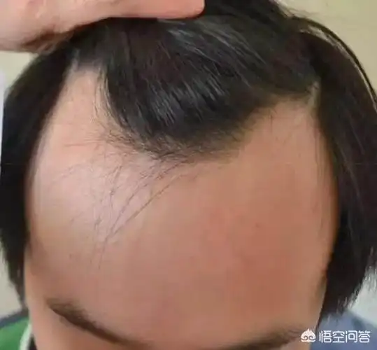 头条问答 - 男生m字型发际留什么发型好看?(19个回答)