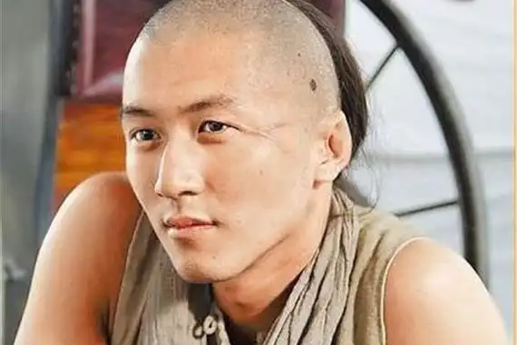 谢霆锋的头上为什么有黑痣曾患有皮肤癌