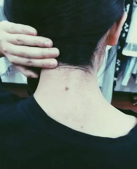 这颗痣叫苦情痣,看完后你就会明白你感情为什么不顺了