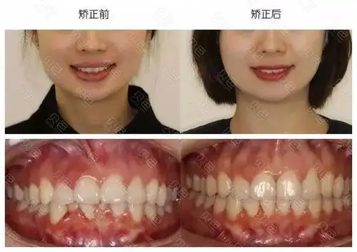 逛社区 >  贝色专栏 >  详细页面参考金额  0元 口腔项目  牙齿矫正