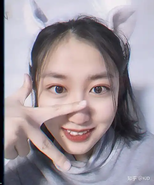 有没有高度近视也漂亮的女孩子呀