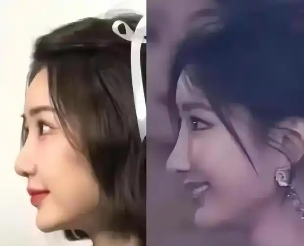 网友质疑毛晓彤整容!在《庆余年》里,假体都要飞出来了!太吓人