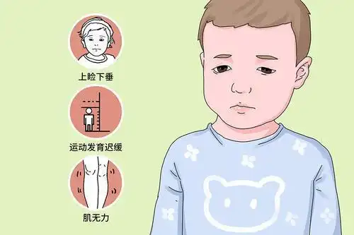 先天性肌无力综合症的临床症状严重是一种较为罕见的遗传性疾病