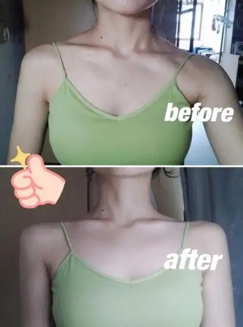 发达的斜方肌还有救速看