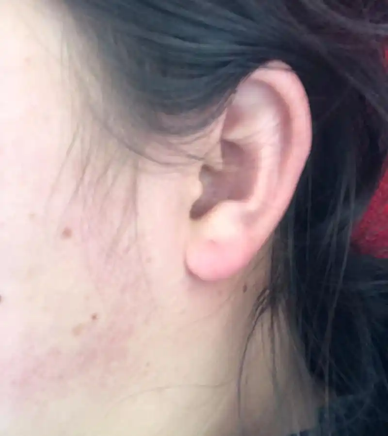 老一辈的人说耳朵小的人没福气 很少有人的耳朵像我一样小了吧,老一辈