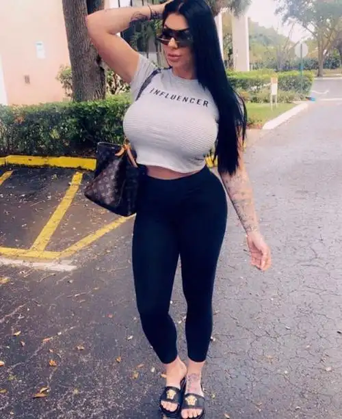 lindi的家人很支持她的事业,但不希望她做太多整容手术,lindi说:"曾有