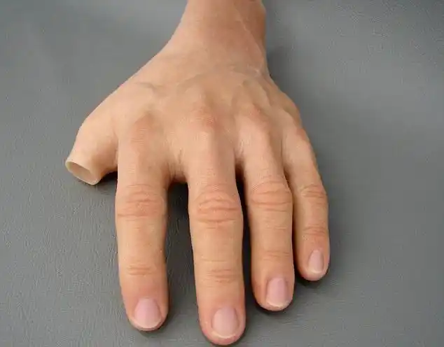 关于美容假肢手的一些介绍