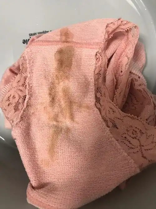 孕32周内裤分泌物