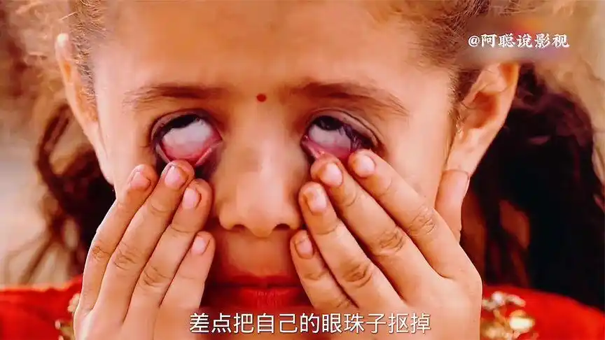 女孩差点抠掉眼珠子 ,只因母亲说她是灾星.