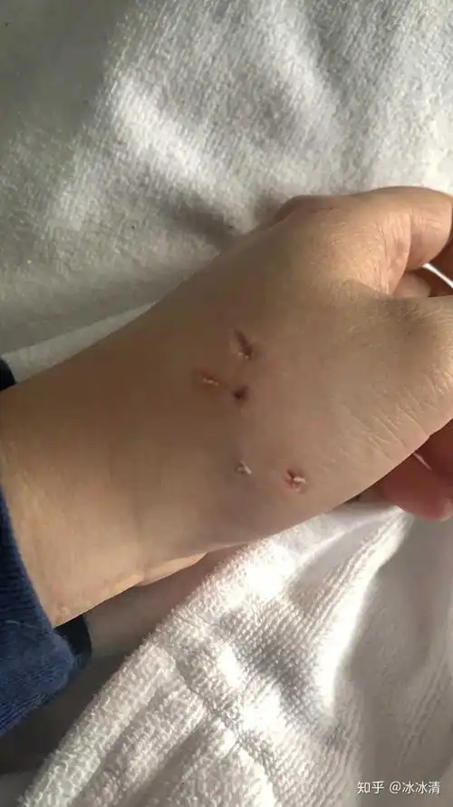 把手放进猫咪嘴里它会用力咬你吗.