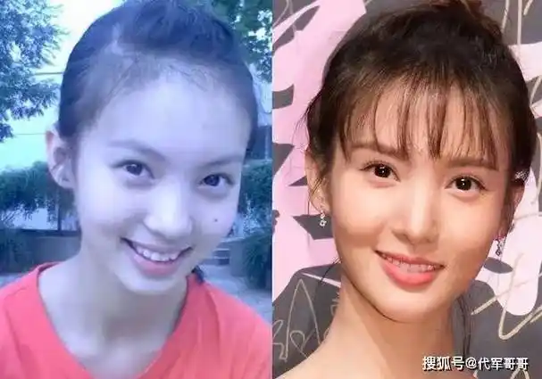金晨12年前原来长这样!和现在完全不像,网友直呼:可惜了