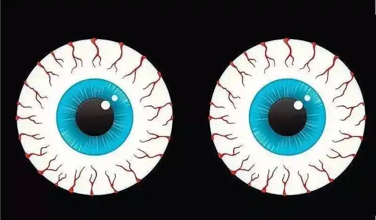 眼里经常出现红血丝,这些问题要注意!_眼睛_隐形眼镜_企业