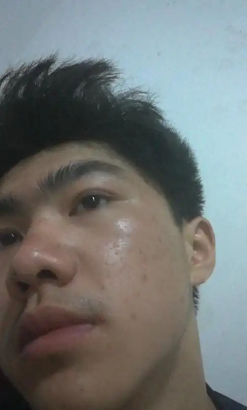 这个脸油的不行,可以去角质吗.一叶子的去角质素可以用吗,谢谢