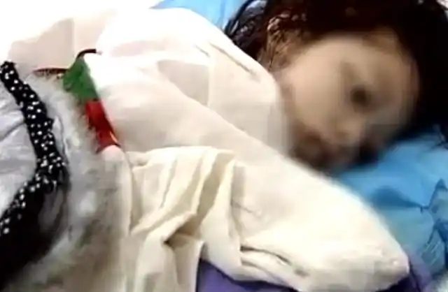 真实故事四川11岁女孩患骨结核全身溃烂长蛆哭喊想见父母一面