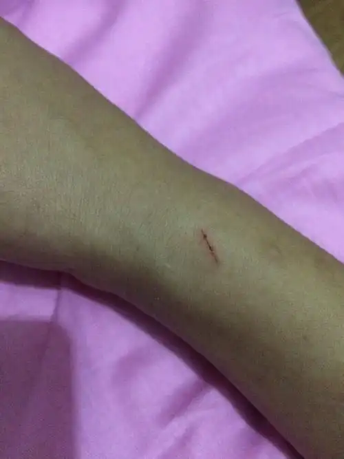 被猫抓了个小伤口,半天了,公司养的猫,不打狂犬疫苗可以吗?怎么办呢?