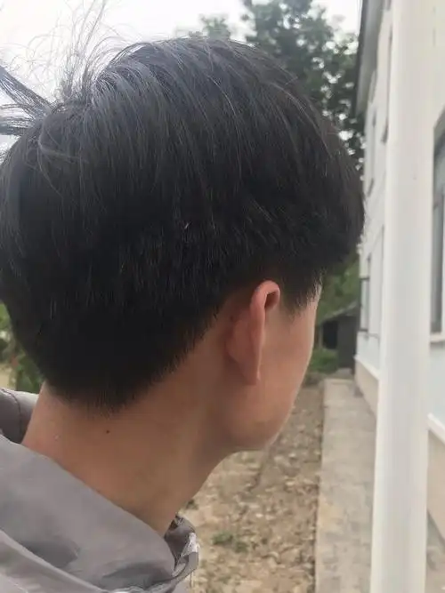 后面长了好多白头发 一两年了 不是遗传 因为什么?