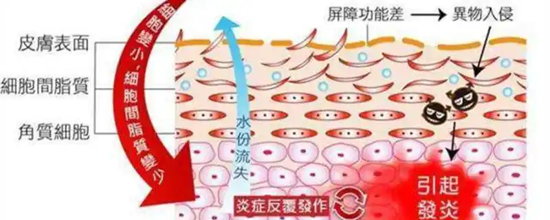 角质层受损有什么护理方法