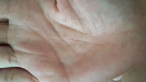 我得生命线上段有岛纹,是有灾难吗而且还有很多叉.