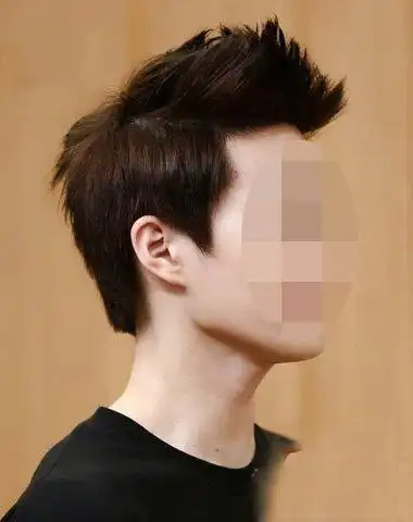 价格受到了很多因素的影响,鬓角种植手术费用是不统一的;鬓角植发技术