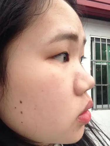 这样的鼻子塌吗?会不会很丑