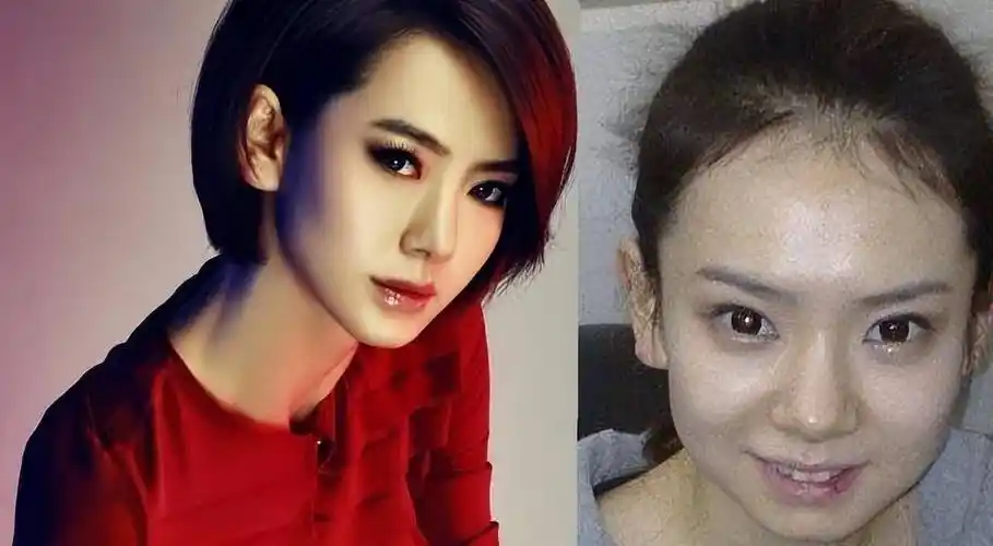 早期照片曝光区别大,网友直呼:变化太明显了_双眼皮_手术_气质