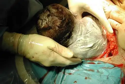 生孩子顺产是最高痛的为什么大多数孕妇能撑过去