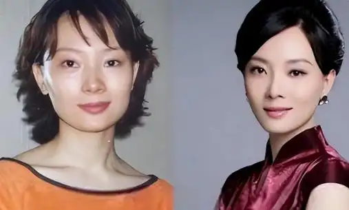 这一次,靠整容吃尽红利的陈数,最后还是迎来了"反噬"