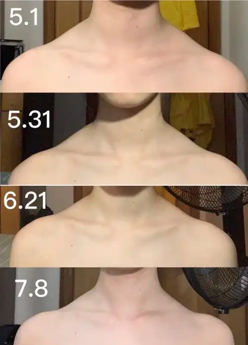 斜方肌到底能不能练掉啊?