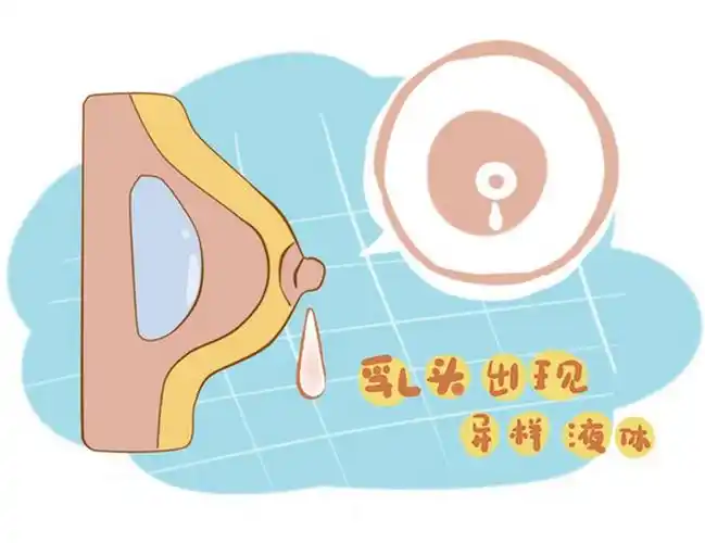 乳头溢液需要做什么检查
