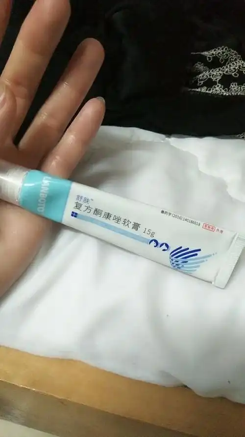 酮康唑软膏 宠物猫癣狗狗真菌螨虫湿疹皮癣皮肤病药膏消肿止痒晒单图