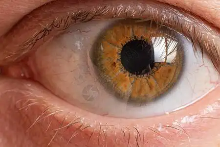棕色的眼睛图片
