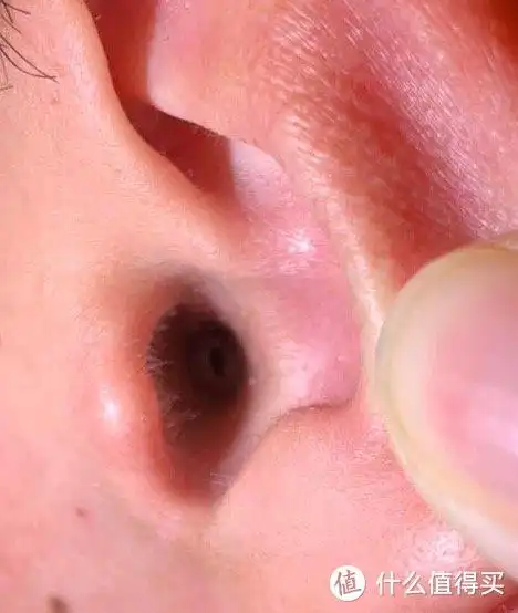耳朵内黑色一圈的部位,在耳道内,真的很深的位置