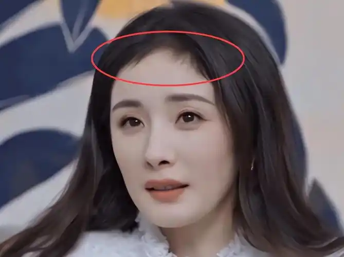 年纪轻轻就秃头,这些女明星嘴上说着不在乎,实际上都在植发_杨幂_头发