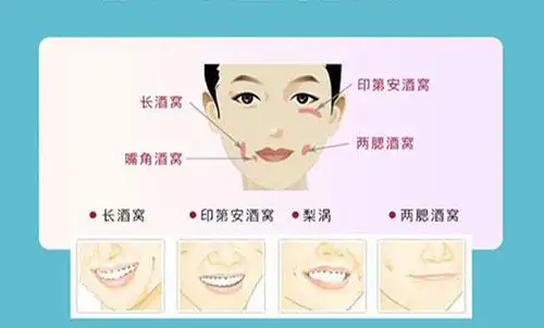 酒窝整形术是永久的吗?