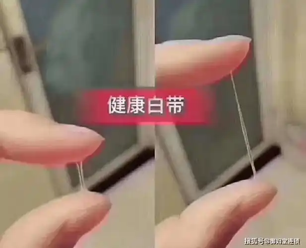 白带突然变得清澈如水,经常弄湿内裤,并伴有臭味?