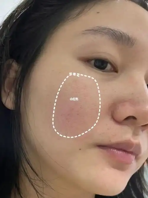 希望所有毛孔粗大的姐妹都能看到
