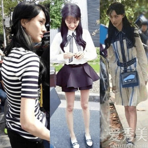 爆青筋 脸凹陷 畸形腿 这些女星一瘦毁所有 这些女星一瘦毁所有 郑爽