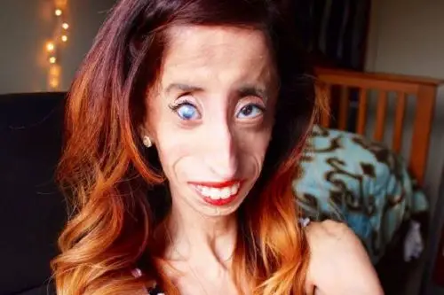 全世界最丑女人笑对恶言拍纪录片鼓励他人图