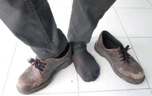 男人脚臭?可能和2个原因有关,用好4个小招,助缓解脚臭不尴尬