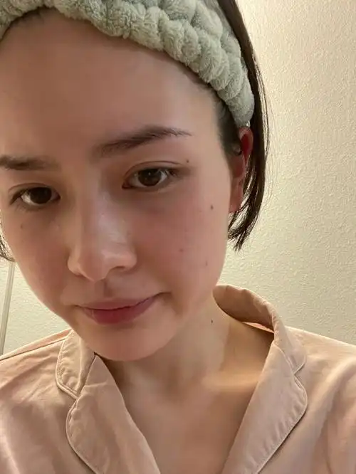 稳定 姨妈快来了 脸上开始爆痘 不开心7115#我的自拍分享  #素颜