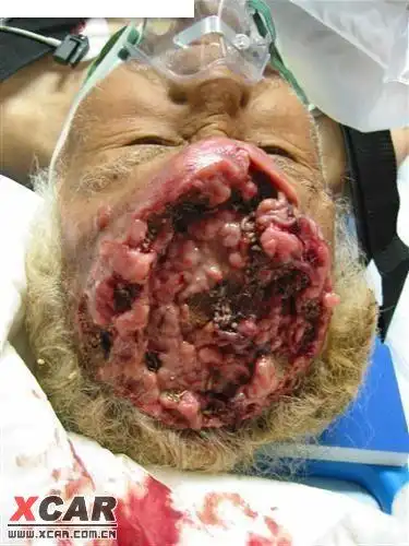 史上最恶心的图片---18岁以下勿入